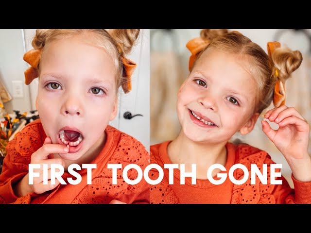 ESME LOSES HER FIRST TOOTH